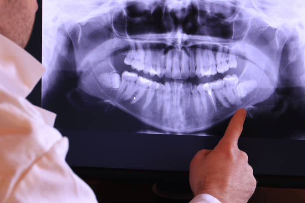 Best Dental Abscess Treatment in Jeffersonville, KY