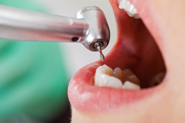 Best Emergency Pediatric Dental Care in Jeffersonville, KY